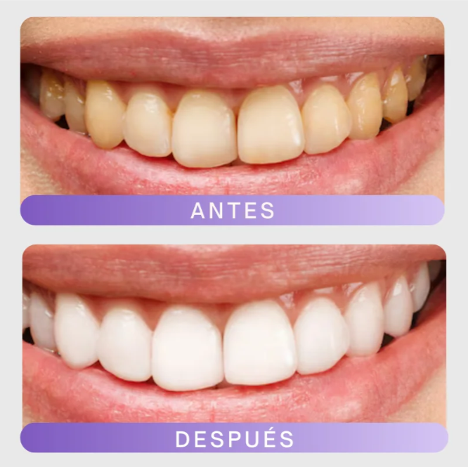 Pasta Dental Blanqueadora - V34: Llevate 3 y pagá 1 🎁